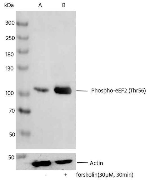 Anti-Human EEF2 Antibody [A1269] - ABMIUM