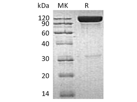Recombinant Human ICAM-1/CD54 Protein (Fc Tag) - ABMIUM