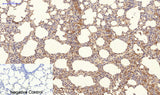 Immunohistochemistry of paraffin-embedded Rat lung tissue using NBR1 Monoclonal Antibody at dilution of 1:200.