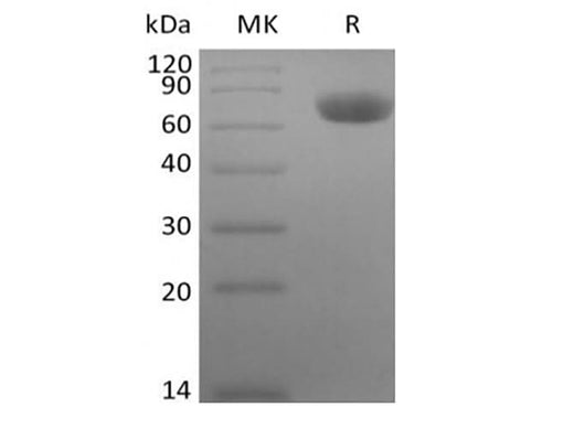 Recombinant Rhesus Macaque TNF Receptor II/TNF RII/TNFRSF1B/CD120b (C-Fc) - ABMIUM