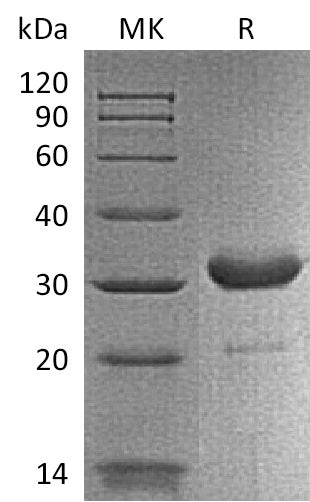 Recombinant Mouse IgG2b-Fc Protein - ABMIUM