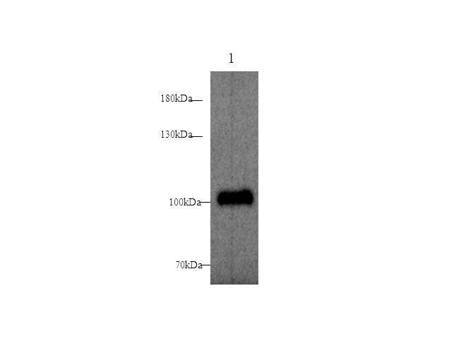 Anti-Mouse ST14 Antibody - ABMIUM