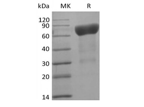 Recombinant Human IL-6 Receptor Subunit alpha/IL-6RA/CD126 (C-Avi-6His) Biotinylated - ABMIUM