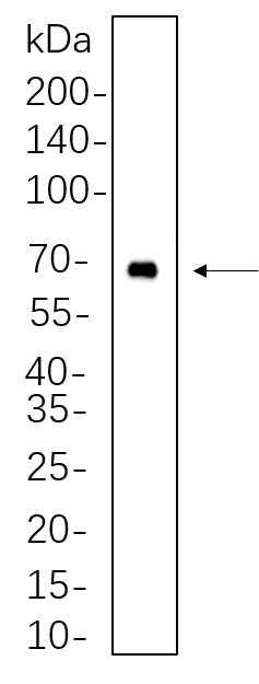 Anti-Human Btk Antibody [B642] - ABMIUM