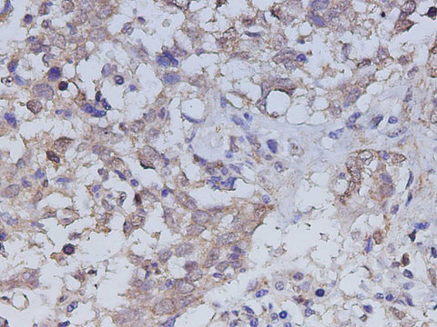 Anti-Human ILK Antibody - ABMIUM