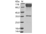 Recombinant EBOV (subtype Zaire, strain H.sapiens-wt/GIN/2014/Kissidougou-C15) Glycoprotein / GP-RBD Protein (Fc Tag) - ABMIUM