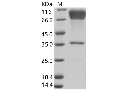 Recombinant EBOV (subtype Zaire, strain H.sapiens-wt/GIN/2014/Kissidougou-C15) Glycoprotein / GP-RBD Protein (Fc Tag) - ABMIUM