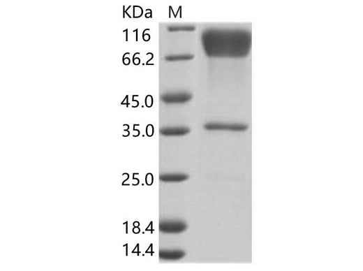 Recombinant EBOV (subtype Zaire, strain H.sapiens-wt/GIN/2014/Kissidougou-C15) Glycoprotein / GP-RBD Protein (Fc Tag) - ABMIUM