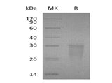 Recombinant Human TMIGD2/IGPR-1 Protein (His Tag) - ABMIUM
