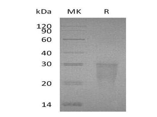 Recombinant Human TMIGD2/IGPR-1 Protein (His Tag) - ABMIUM