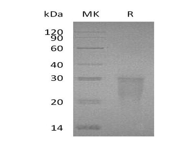 Recombinant Human TMIGD2/IGPR-1 Protein (His Tag) - ABMIUM