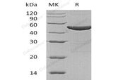Recombinant Human ASS1 Protein (His Tag) - ABMIUM