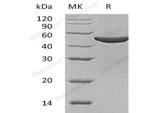 Recombinant Human ASS1 Protein (His Tag) - ABMIUM