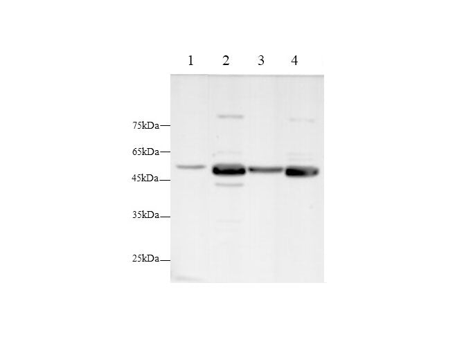 Anti-Human/Mouse/Rat LUM Antibody - ABMIUM
