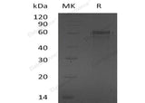 Recombinant Human ZNF70 Protein (His Tag) - ABMIUM
