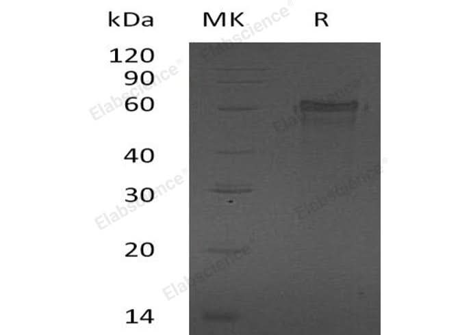 Recombinant Human ZNF70 Protein (His Tag) - ABMIUM