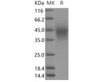 Recombinant Human TMEM25 Protein (His Tag) - ABMIUM
