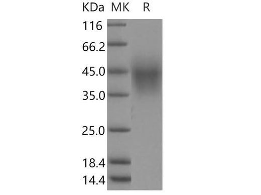 Recombinant Human TMEM25 Protein (His Tag) - ABMIUM