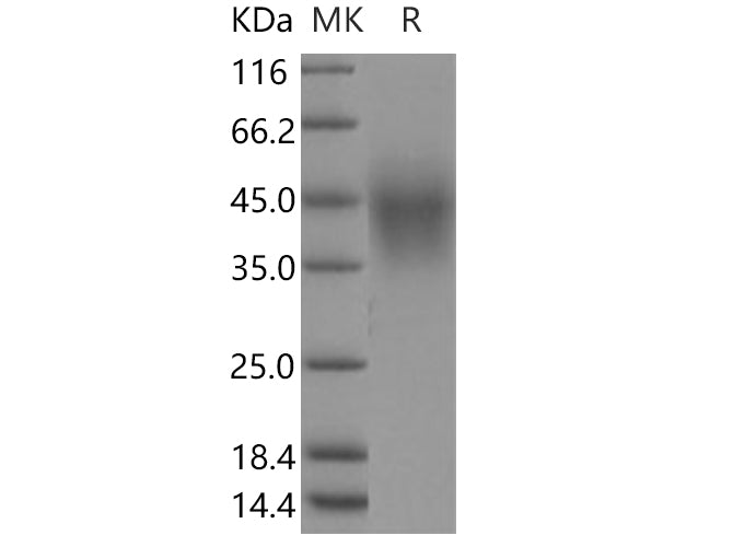 Recombinant Human TMEM25 Protein (His Tag) - ABMIUM