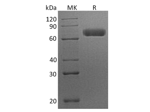 Recombinant Human EphA7/EHK3 Protein (His Tag) - ABMIUM