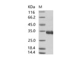 Recombinant SARS-CoV Spike/RBD Protein (RBD, His Tag) - ABMIUM