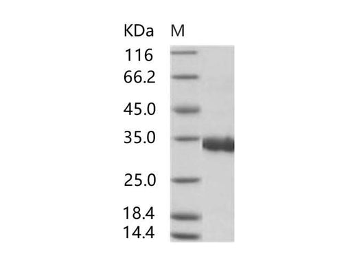 Recombinant SARS-CoV Spike/RBD Protein (RBD, His Tag) - ABMIUM