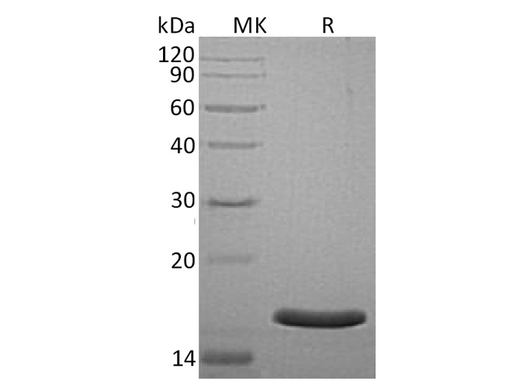 Recombinant Human AGR3 Protein (His Tag) - ABMIUM