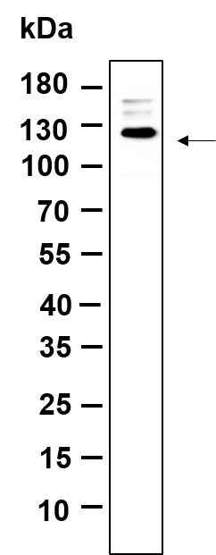 Anti-Human/Mouse Rb Antibody [B1154] - ABMIUM