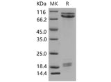 > 85 % as determined by reducing SDS-PAGE.
