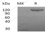 Recombinant Human Contactin 2/CNTN2 Protein (His Tag) - ABMIUM
