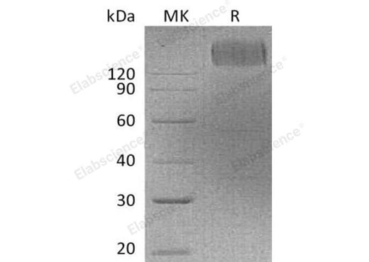 Recombinant Human CEACAM5/CEA Protein (Fc Tag) - ABMIUM