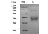 Recombinant Human NFYA Protein (GST Tag) - ABMIUM