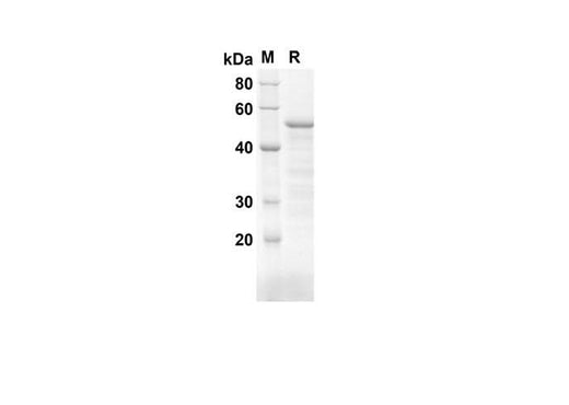 SDS-PAGE analysis of Mouse Cd34 proteins, 2 μg/lane of Recombinant Mouse Cd34 proteins was resolved with SDS-PAGE under reducing conditions, showing bands at 47.7 kDa.
