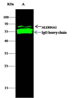 Anti-Human ALDH4A1 Antibody [B180]