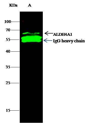 Anti-Human ALDH4A1 Antibody [B180] - ABMIUM