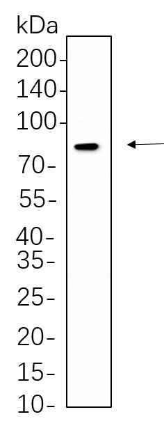 Anti-Human/Mouse/Rat/Bovine DRP1 Antibody [B1084] - ABMIUM