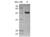 Recombinant Human SCLY Protein (His Tag) - ABMIUM