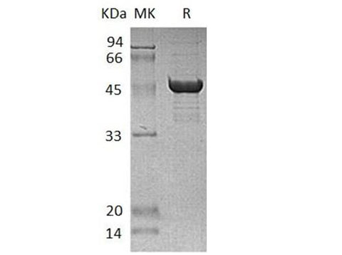 Recombinant Human SCLY Protein (His Tag) - ABMIUM