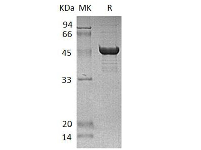 Recombinant Human SCLY Protein (His Tag) - ABMIUM