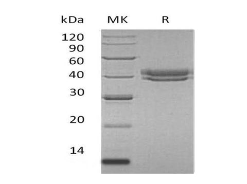 Recombinant Human CFHR1 Protein (His Tag) - ABMIUM