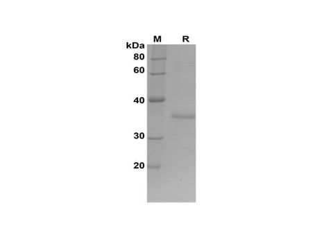 SDS-PAGE analysis of Mouse GDF11/BMP-11 proteins, 2 μg/lane of Recombinant Mouse GDF11/BMP-11 proteins was resolved with SDS-PAGE under reducing conditions, showing bands at 36 kDa.