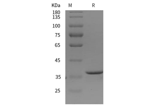 SDS-PAGE analysis of Human MMP-2/CLG4A proteins, 2 μg/lane of Recombinant Human MMP-2/CLG4A proteins was resolved with SDS-PAGE under reducing conditions, showing bands at 38 kDa.