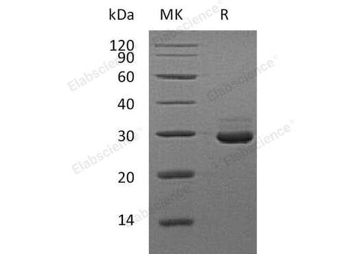 Recombinant Mouse VSIG8 Protein (His Tag) - ABMIUM