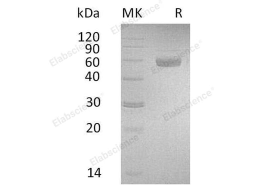 Recombinant Human PSG3 Protein (His Tag) - ABMIUM
