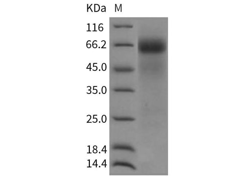 Recombinant Rat FGFR4/CD334 Protein (His Tag) - ABMIUM