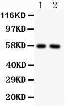 Anti-Alkaline Phosphatase/ALPL Antibody Picoband® Boster Bio