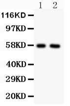 Anti-Alkaline Phosphatase/ALPL Antibody Picoband® Boster Bio