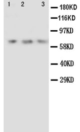 Anti-Angiopoietin 2/ANGPT2 Antibody Picoband® Boster Bio