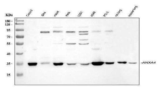 Anti-Annexin IV/ANXA4 Antibody Picoband® Boster Bio