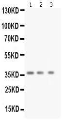Anti-BDNF Antibody Picoband® Boster Bio